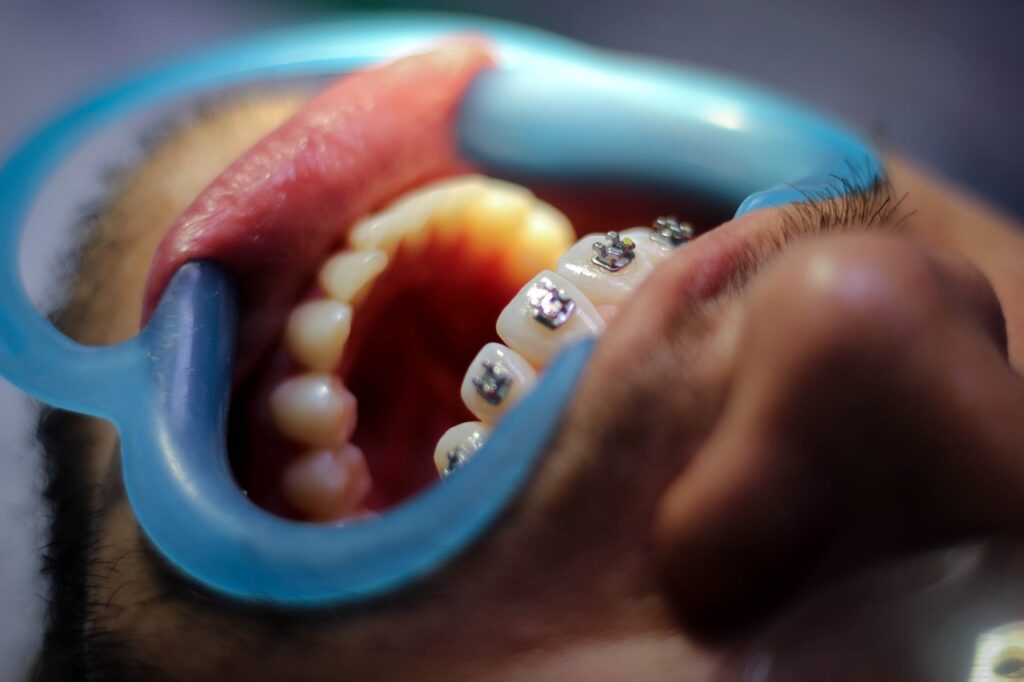 orthodontics, dentistry, patient-5764087.jpg