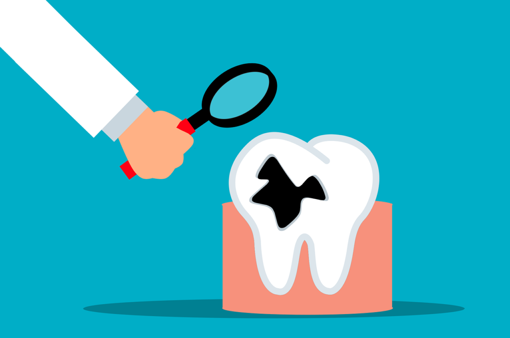 tooth decay, dentist, dental-7283701.jpg